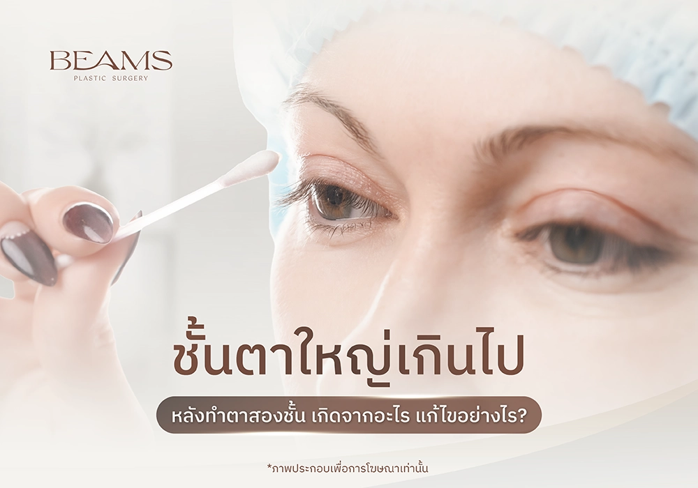 ชั้นตาใหญ่เกินไป