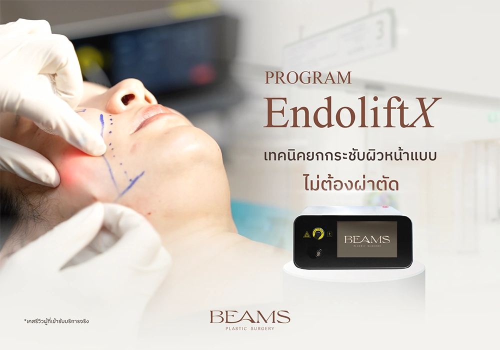 โปรแกรม Endolift