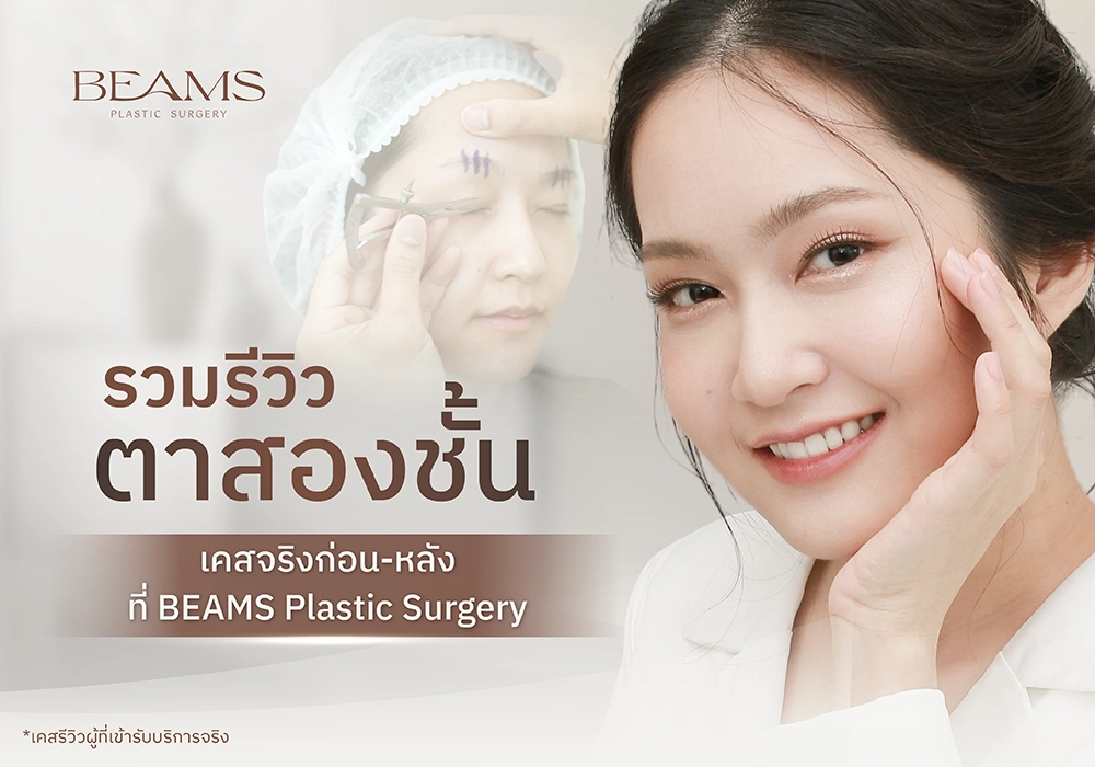 รวมรีวิวตาสองชั้น BEAMS Clinic