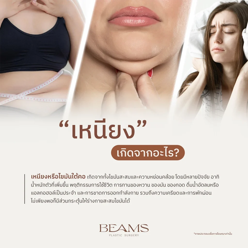 เหนียงเกิดจากอะไร