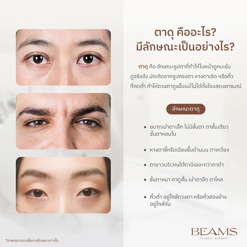 ลักษณะของตาดุ