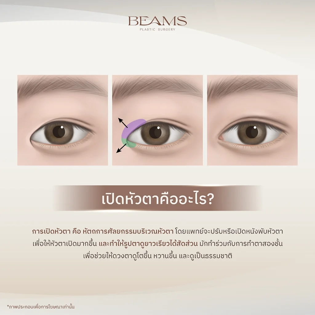 เปิดหัวตา คืออะไร