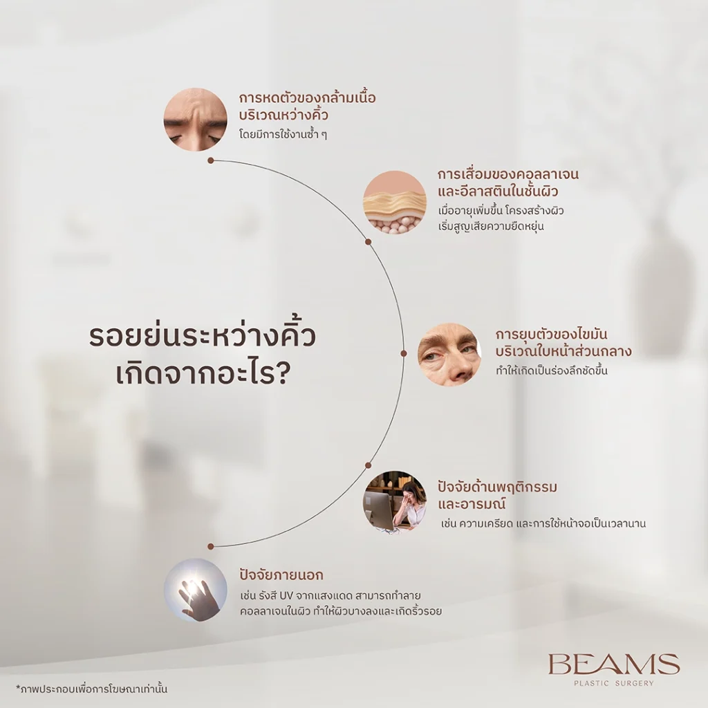 รอยย่นระหว่างคิ้ว คืออะไร