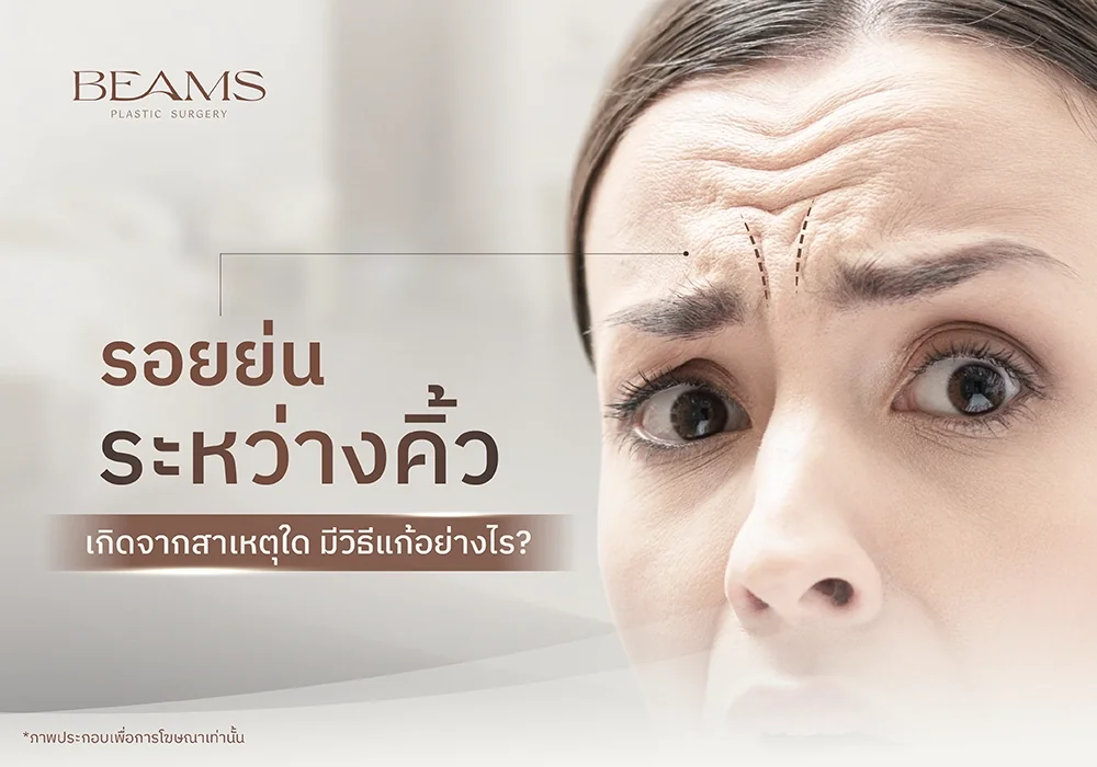 วิธีลดรอยย่นระหว่างคิ้ว