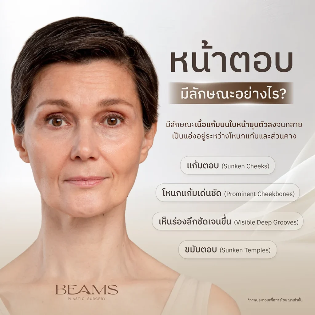 ลักษณะของคนหน้าตอบ