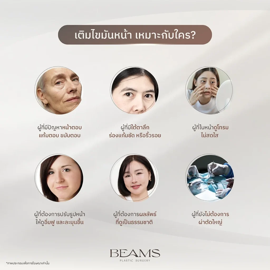 เติมไขมันหน้าเหมาะกับใคร