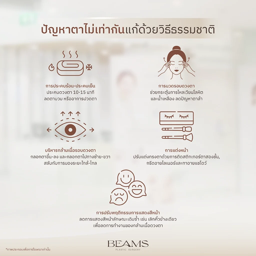 แก้ปัญหาตาไม่เท่ากันด้วยวิธีธรรมชาติ