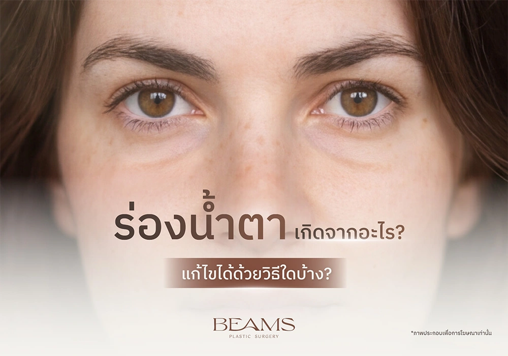 ร่องน้ำตา