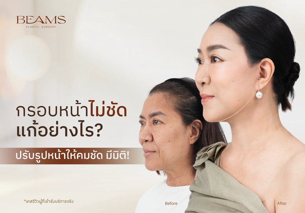 กรอบหน้าไม่ชัด