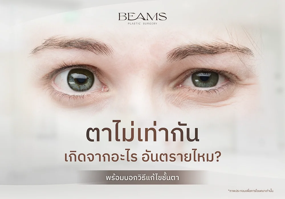 ตาไม่เท่ากัน เกิดจากอะไร