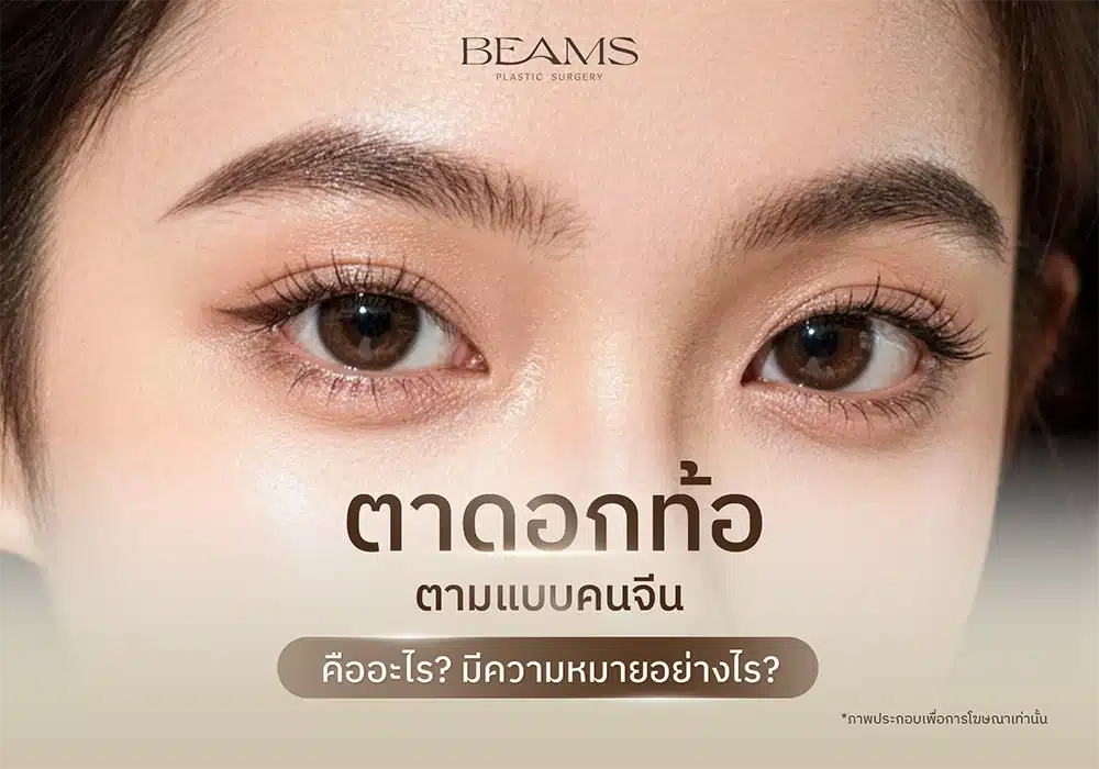 ตาดอกท้อคืออะไร
