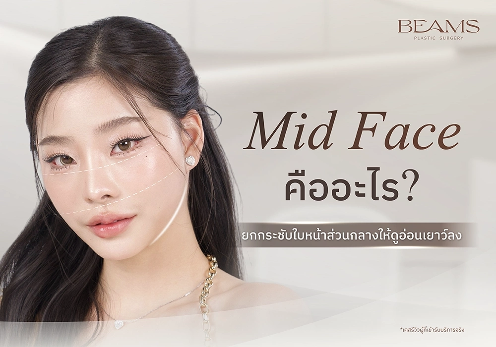 Midface คืออะไร