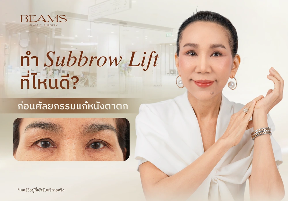 ทำ Subbrow Lift ที่ไหนดี