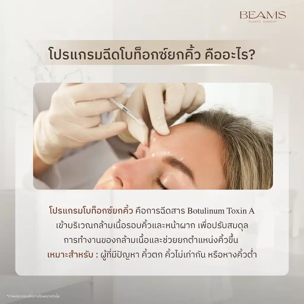 โบท็อกซ์ยกคิ้ว คืออะไร