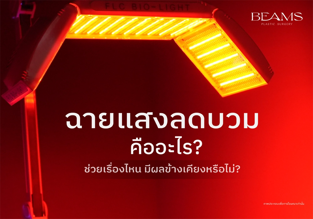 การฉายแสงลดบวม