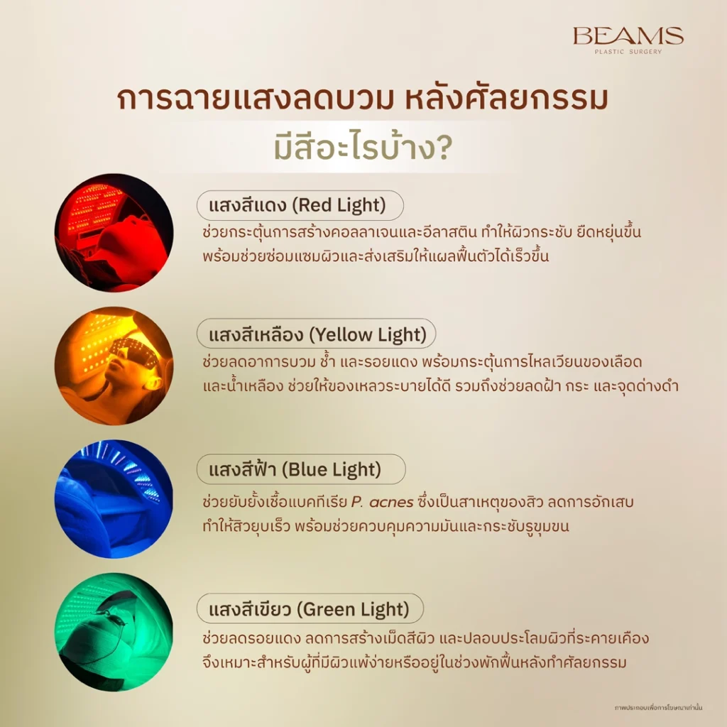ฉายแสงลดบวมมีสีอะไรบ้าง